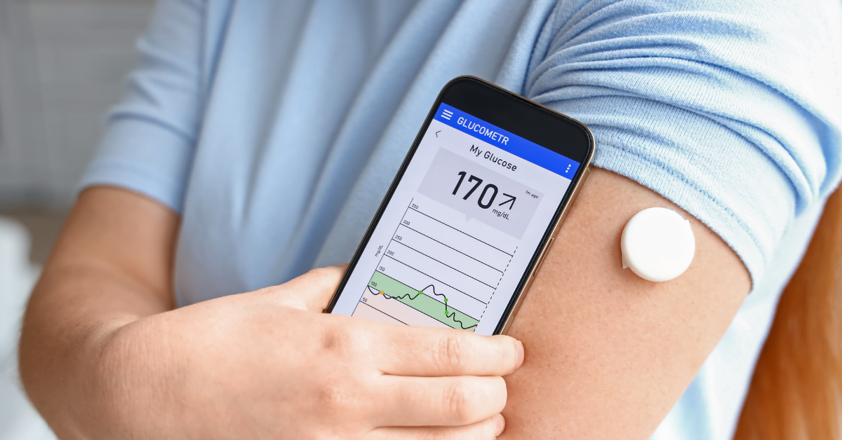 Man holding his smartphone with the CGM app next to his CGM on his arm