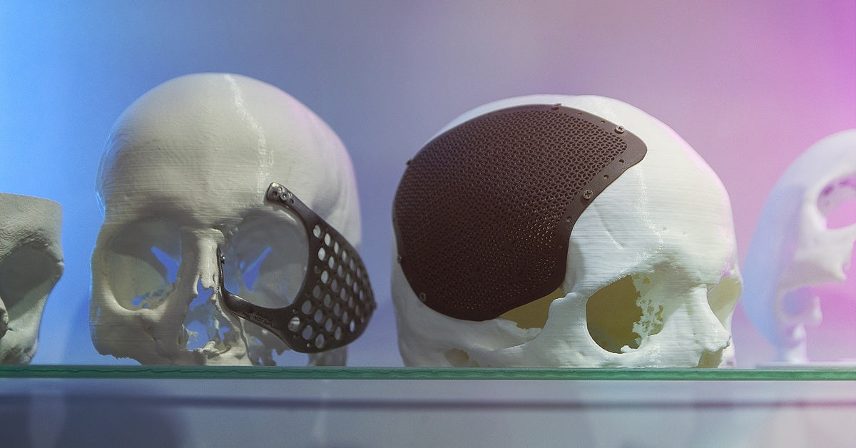 Two 3D-printed human skulls with black surgical implant plates covering the eye of one and part of the cranium of the other.