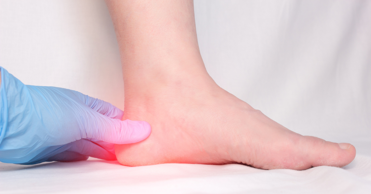 Doctor's hand in medical glove examines a patient's heel spur, pain in the heel and foot